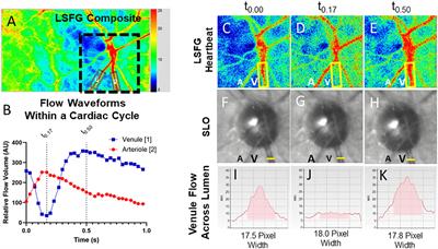 Retinal arterial–venous pulse delay: a new specific marker for a carotid–cavernous fistula